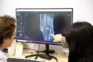 Hitit Ünv.'nde Yapay Zeka ile Ön Çapraz Bağ Teşhisi