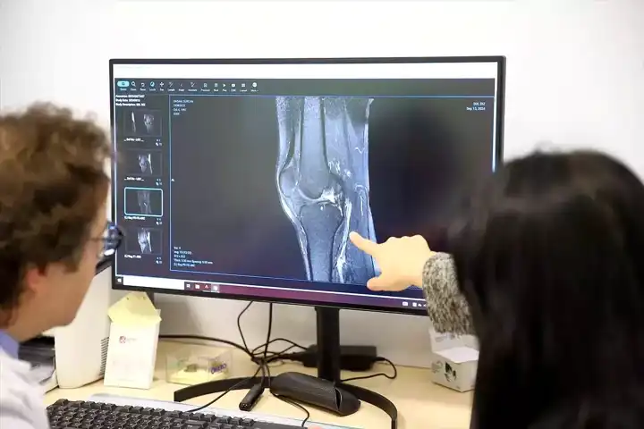 Hitit Ünv.'nde Yapay Zeka ile Ön Çapraz Bağ Teşhisi